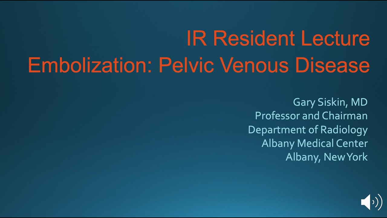 Embolization Pelvic Venous Disease 2020