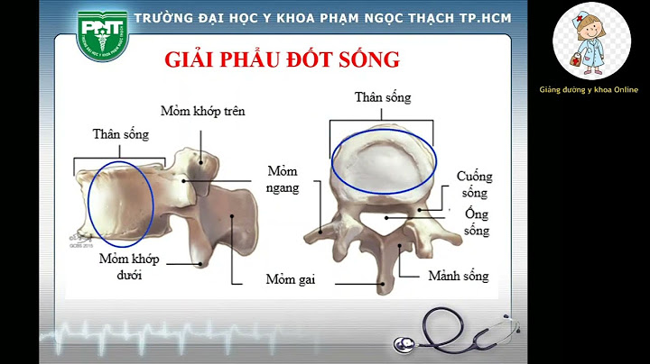 Bài giảng thoái hóa cột sống trên xquang năm 2024