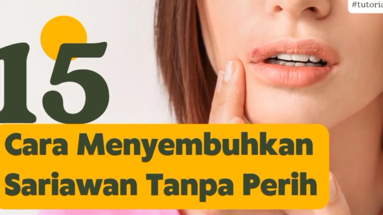 15 Cara Menyembuhkan Sariawan di Bibir Tanpa Perih YouTube