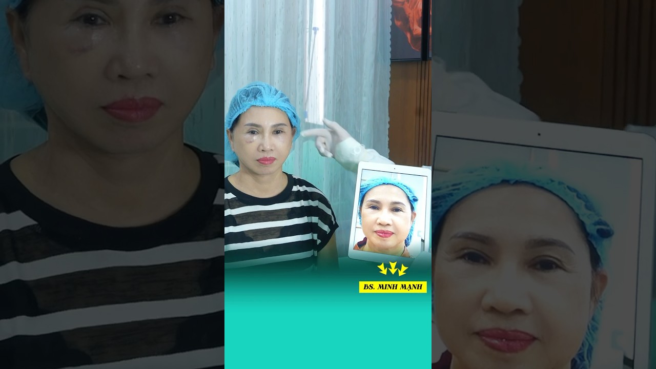 m88 main casino club mansion Lấy lại thanh xuân sau 90 phút lamdep cangdamat facelift