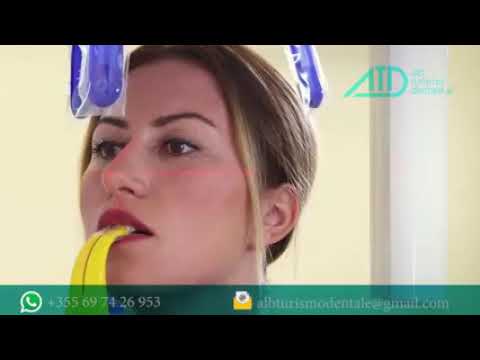 L’importanza dei raggi X  [Dentisti in Albania]