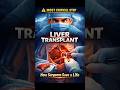 Liver Transplant Surgery Explained | Step-by-Step Medical Animation #shorts