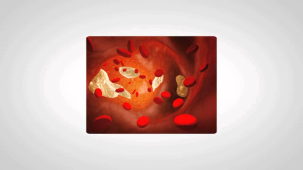 Cholesto Cardio Cholesterol Support