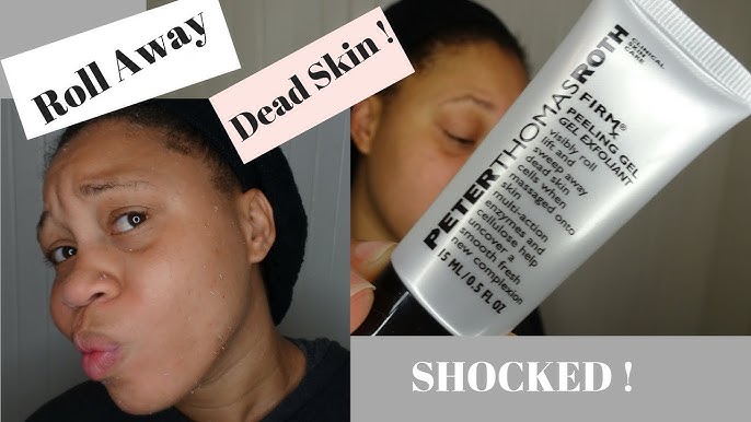 Review: Peter Thomas Roth - PRO Strength Exfoliating Super Peel - WIMJ