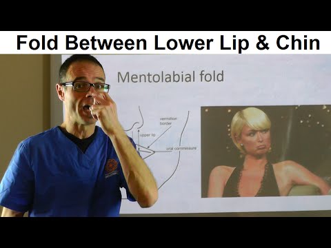 Importance of a Fold Between Lower Lip & Chin Muscle, Mentolabial Fold by Dr Mike Mew
