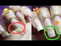 Legit! 🥳 Permanently Fix *and* Grow Out a BAD Nail Break (game-changing but Easy!)