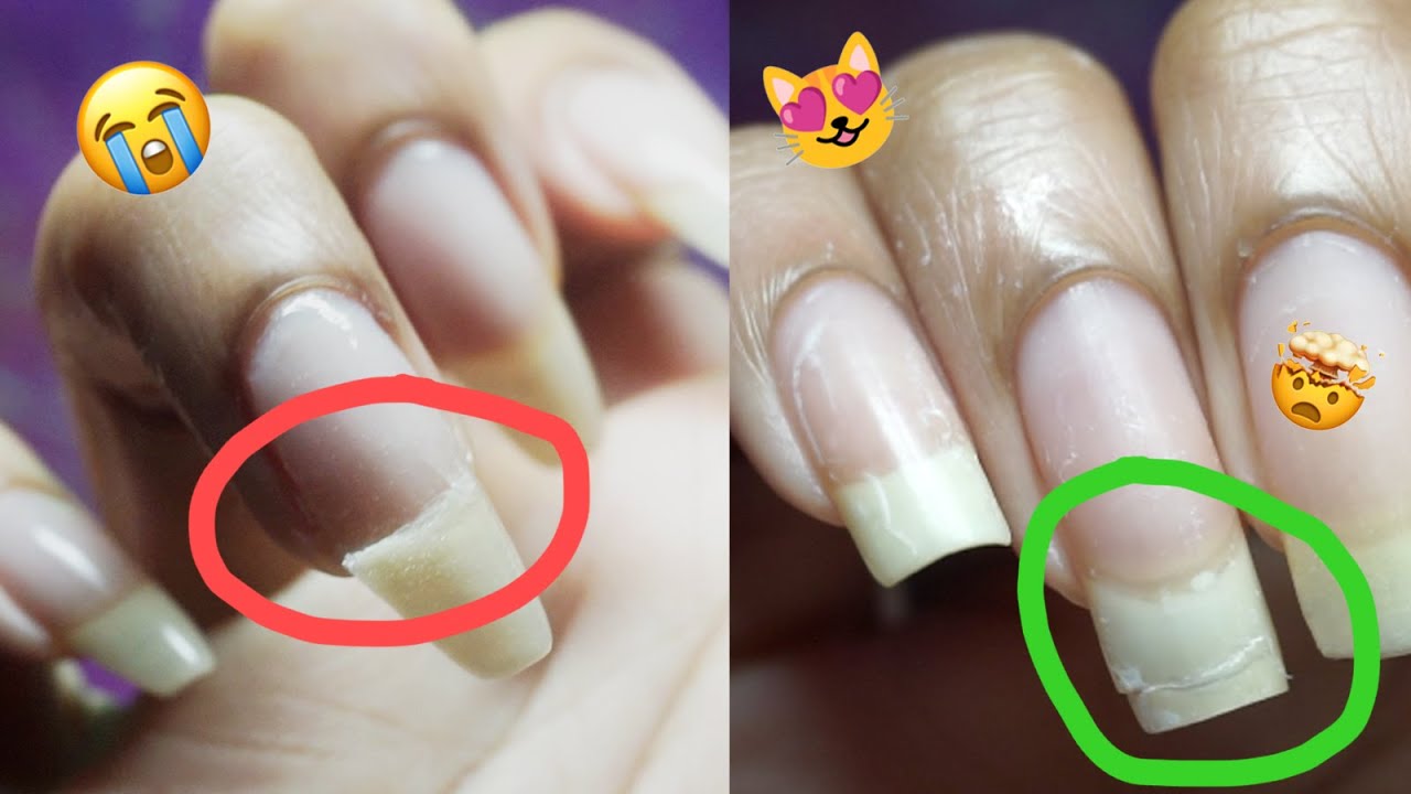 Legit! 🥳 Permanently Fix *and* Grow Out a BAD Nail Break (gamechanging