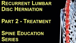 Recurrent Lumbar Disc Herniation. Part 2 -Treatment - Zeeshan Sardar, Spine/Scoliosis Surgeon