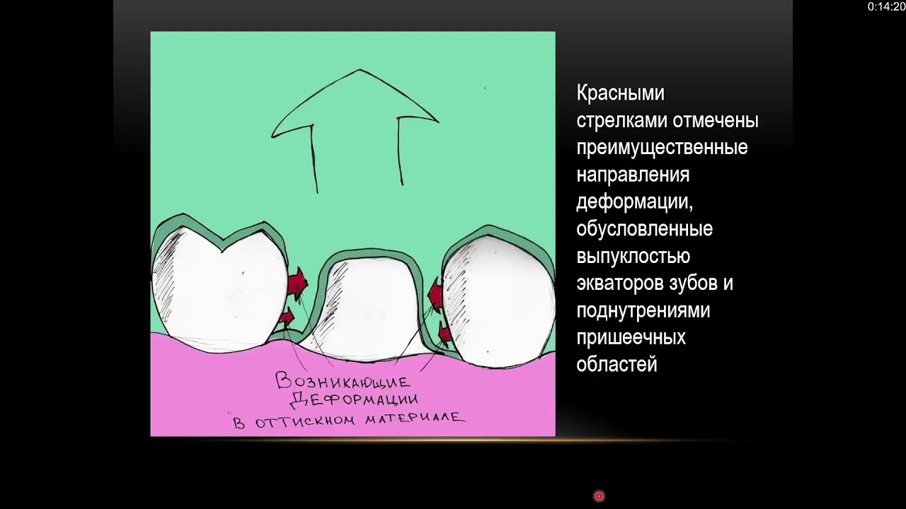 Вест стом материалы
