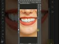 How To Whiten Teeth In Photoshop - Tutorial