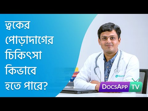 ভিডিও: তাপ কি দাগের জন্য ভালো?