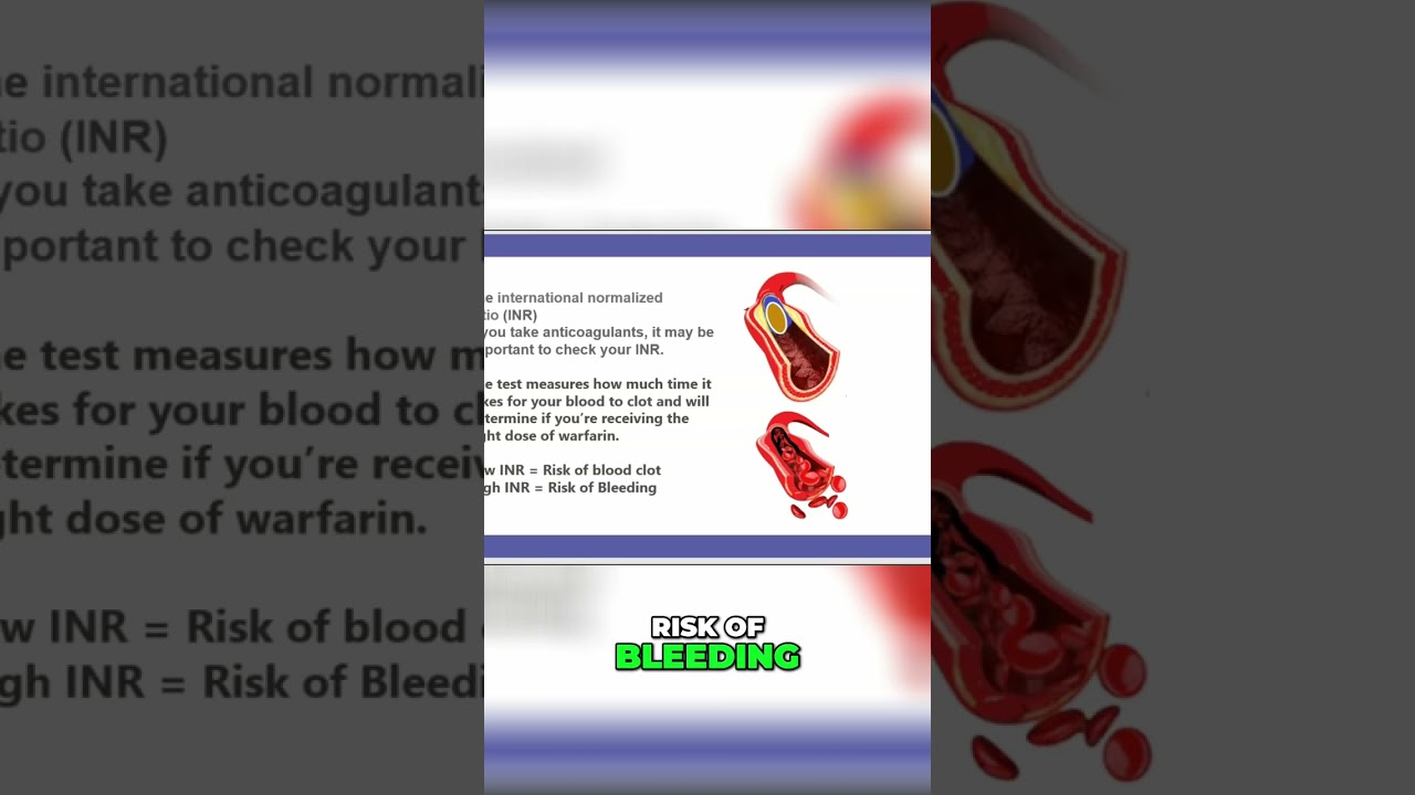 2-Minute INR Levels: Understanding Blood Clot and Bleeding Risks 