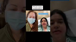 Jaw surgery transformation!