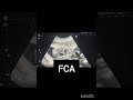 Pregnancy Ultrasound showing fetal cardiac activity! Obstetric Ultrasound!#ultrasoundmadeeasy86 #uk