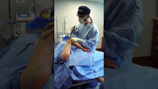 Interview DURING Awake Liposuction Procedure! #cosmeticsurgery  #plasticsurgeon #liposuction