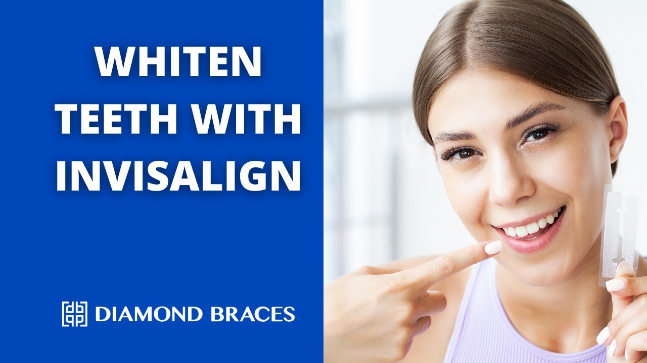 Bleaching With Invisalign