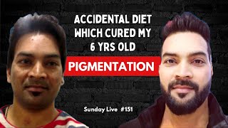 Accidental diet which cured my 6 year old Melasma. Sunday Live #150 screenshot 1