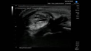 Konica Minolta Ultrasound Simple Needle Visualization Software Snv