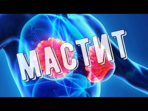 Операция при остром гнойном мастите