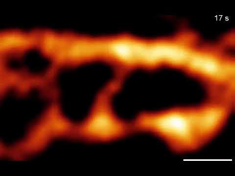 Stable endoplasmic reticulum - plasma membrane junctions compared with dynamic laddered ER elements