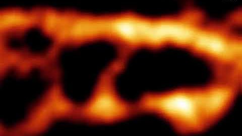 Stable endoplasmic reticulum - plasma membrane junctions compared with dynamic laddered ER elements