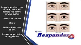 EMS Patient Assessment | Pupils