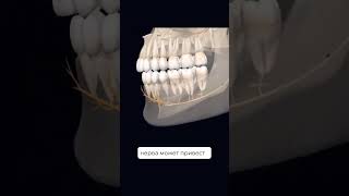 При Воспалении Нерва Чувствительность Теряется, Наблюдается Онемение И Боль В Отдельных Частях Лица