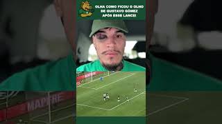 OLHA COMO FICOU O OLHO DO GUSTAVO GÓMEZ! #shorts #shortvideo #palmeiras #gustavogomez OLHA COMO FICOU O OLHO DO GUSTAVO GÓMEZ! #shorts #shortvideo #palmeiras #gustavogomez