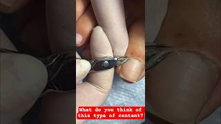 ASMR Pedicure Transformation #asmr #nails #simplenails #satisfying #nailcare #pedicurenails #sort