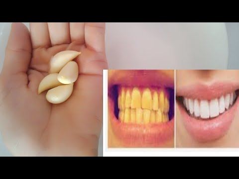 Cách làm trắng răng tại nhà chỉ 3 phú hiệu quả 100% | التبييض بعد 3 دقائق في المنزل فعال 100٪