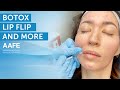 Botox lip flip treatment  more  aafe