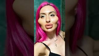 Plastic Surgery Left Them BOTCHED