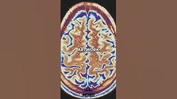 This Is How Your Brain Creates Everything You See