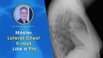 Master Lateral CHEST X-RAYS like a PRO!!