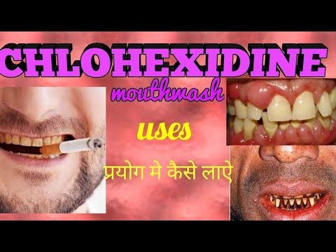 Chlorhexidine mouthwash | Listerine mouthwash | Hexidine mouthwash Uses, how to use