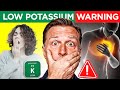 Low Potassium: Symptoms, Signs, Diet, Causes, and Treatment by Dr. Berg