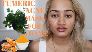 I Tried Tumeric Mask For 5 Days Before And After Results