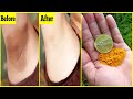 Whiten Dark Underarms Instantly Permanently | 100% Works At Home