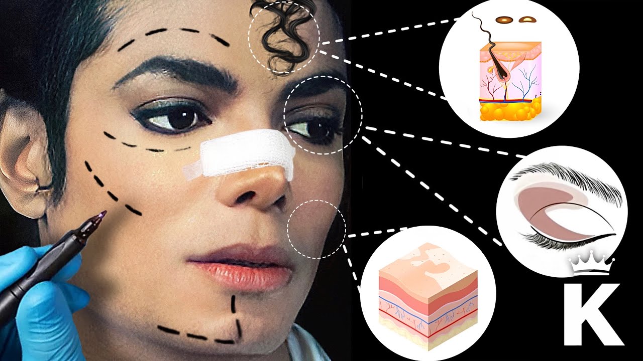 Физические изменения в Майкле Джексоне, не связанные с пластической хирургией | The King Is Come