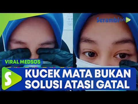 Video: Home Remedies Untuk Mata Gatal: Obat Itu Benar-Benar Bekerja