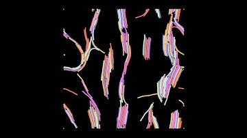 Microtubule Bundle Formation Simulation