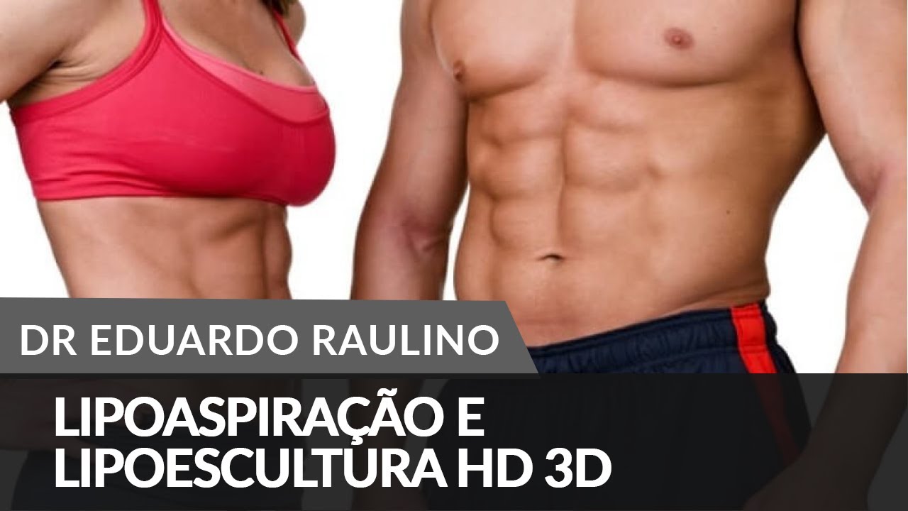 Lipoaspira o E Lipoescultura HD 3D YouTube