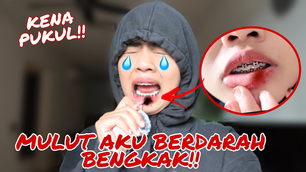 MULUT AKU BERDAR4H TERUK ‼️ TAK NAK BUAT VIDEO DAH!!