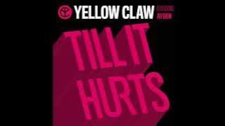 Yellow claw - Till It Hurt ( Sandyzaga,Myco) Edit
