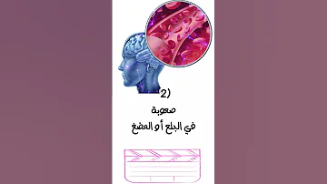 اعراض النزيف الداخلي في الرأس القاتل الخفى أعراض تؤكد الإصابة بنزيف داخلى لا تهملها 