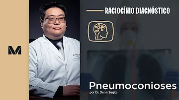 Quais os sinais e sintomas da silicose?