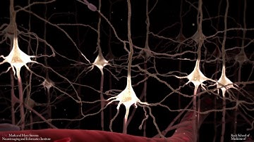 Neurodegeneration caused by Alzheimer