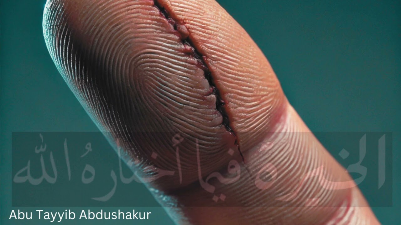 Being Content With Allah's Decree | Short Naseehah