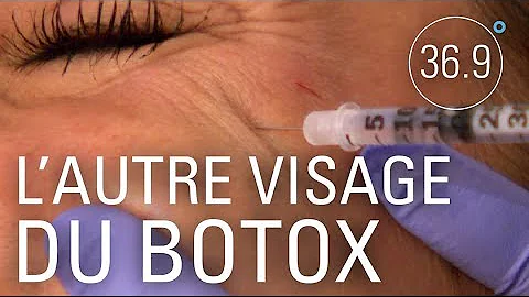 Quels sont les inconvénients du Botox