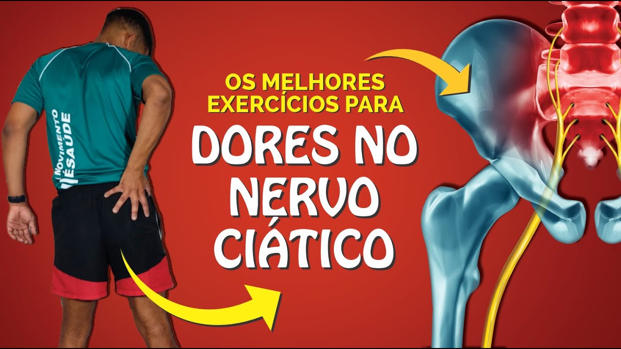 Como Tratar A Dor Do Nervo Ciático – EICQN